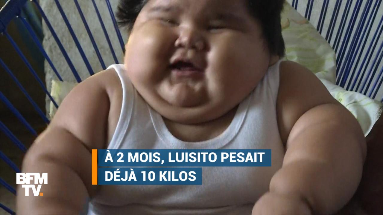Ce Bebe Mexicain Age De 10 Mois Pese Deja 28 Kg